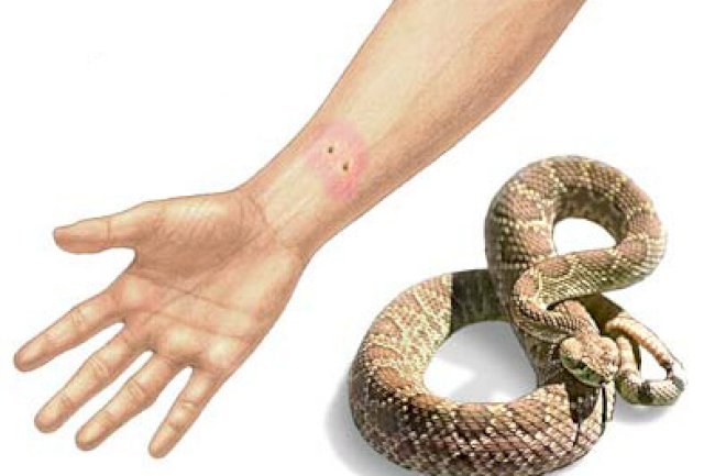 إسعافات عضات الحشرات ولدغات الأفاعي