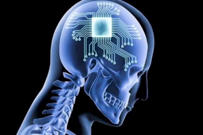  Neuralink Chip